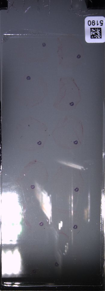 Media type: image; Special Collections 4011   shows specimen_part histological serial section;